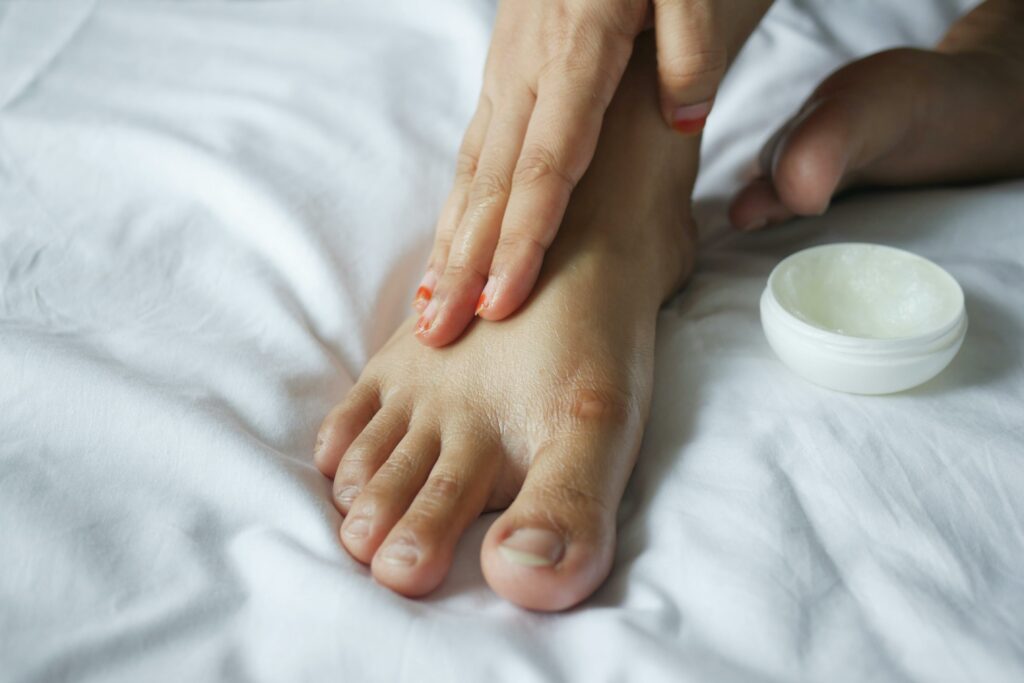 Top Solutions for Wart Removal and Management